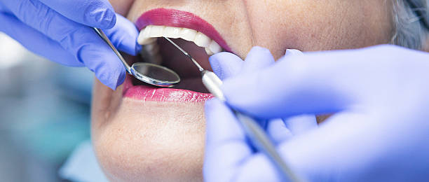 Best Urgent Care for Lost Fillings or Crowns in Lake Havasu City, AZ